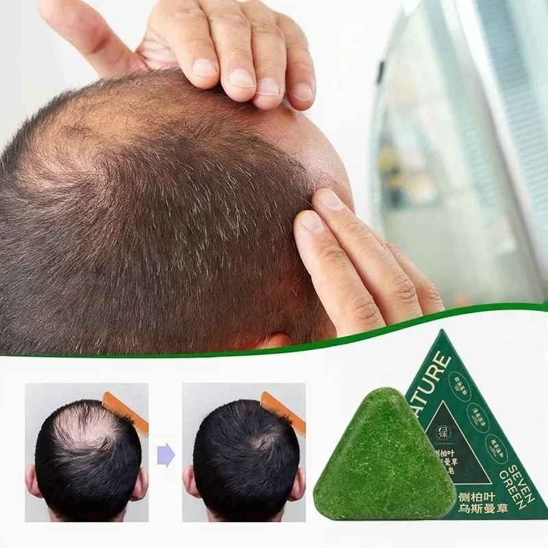 🌿 NATŪRE — أعيدي لشعرك شبابه ✨